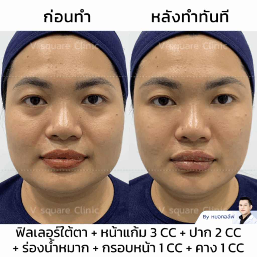 รีวิวร่องน้ำหมาก_คุณทราย