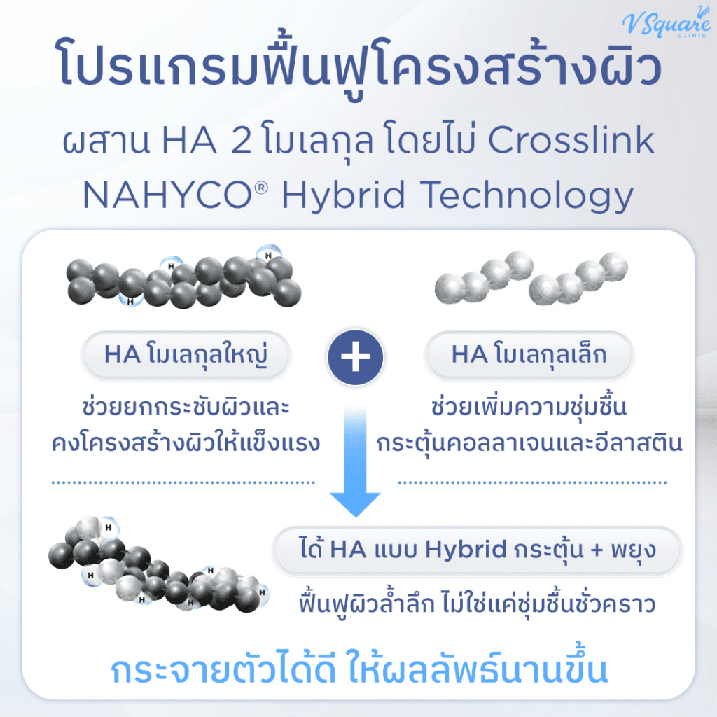 เทคโนโลยี NAHYCO ที่ใช้ผลิต Profhilo