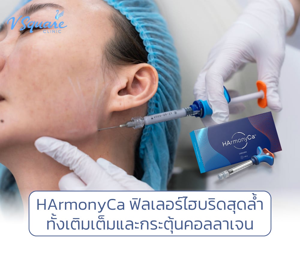 HArmonyCa