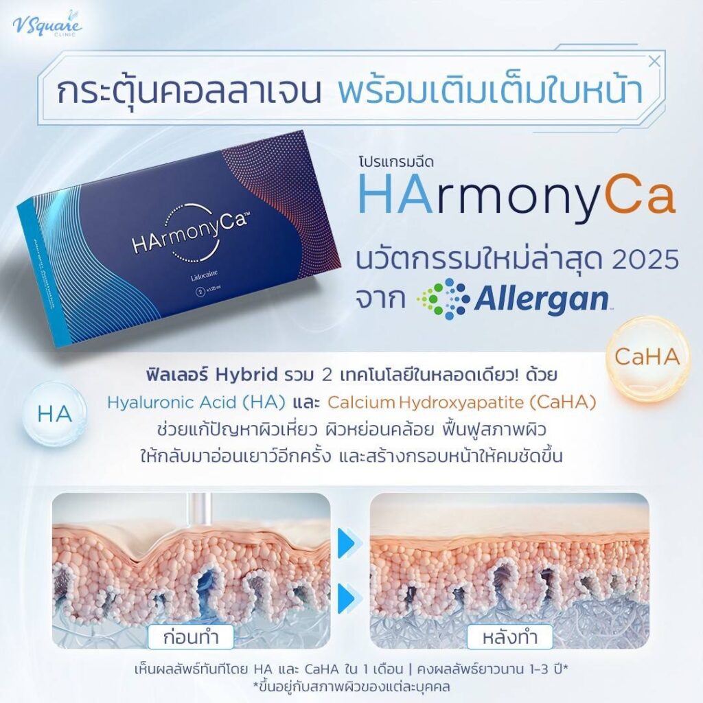 HArmonyCa Hybrid Filler
