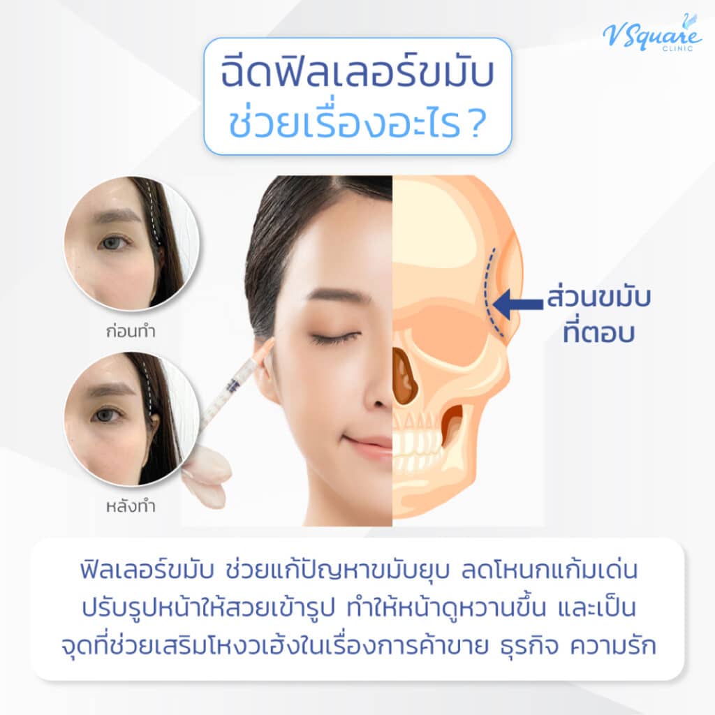 ฉีดฟิลเลอร์ขมับ ช่วยเรื่องอะไร