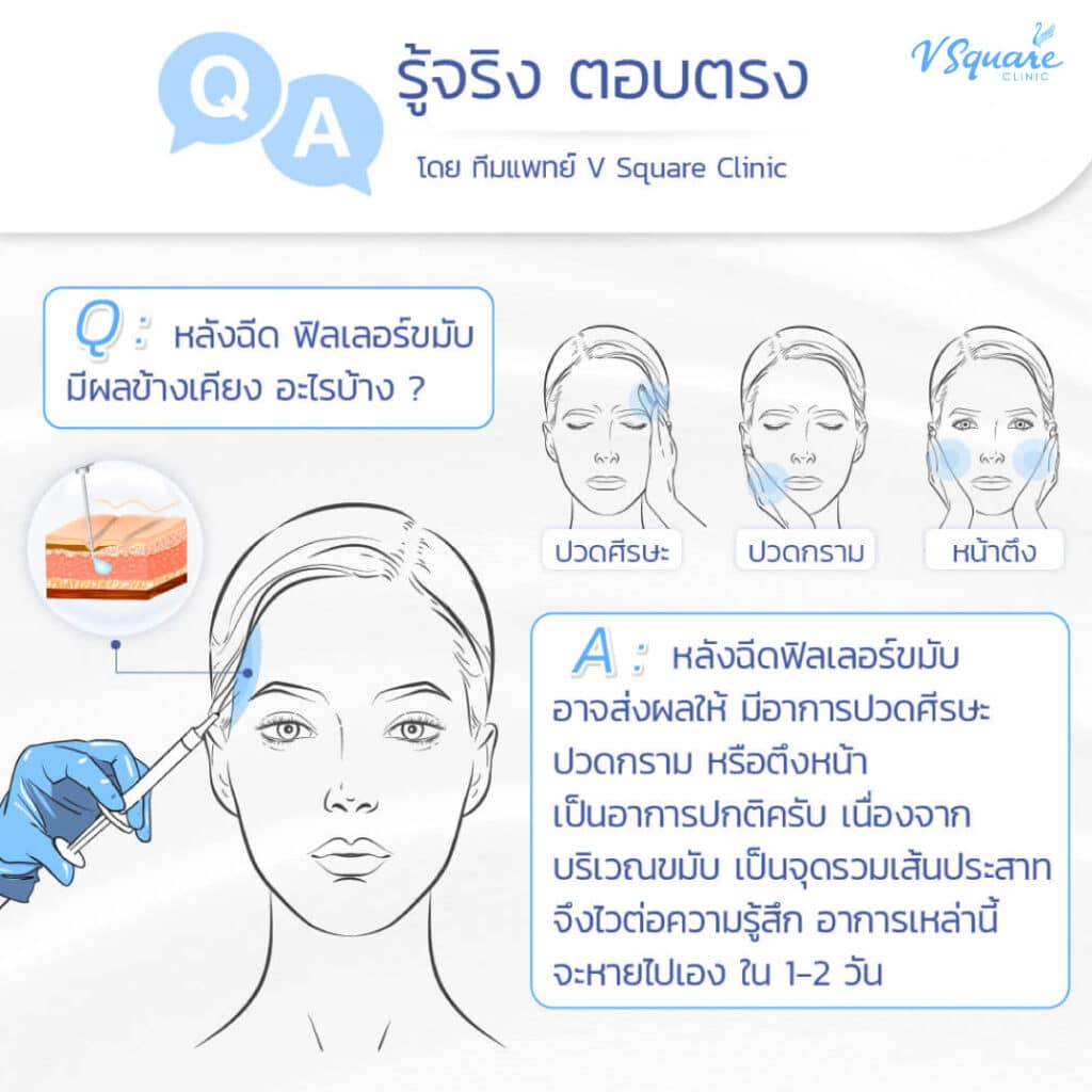 ทำไมฉีดฟิลเลอร์ขมับแล้วปวดหัว ปวดกราม