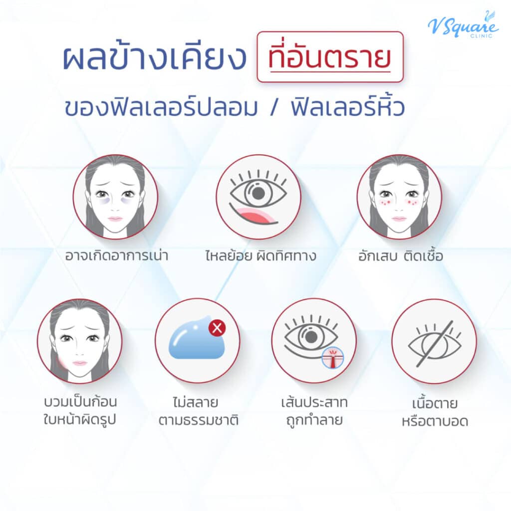 ผลข้างเคียงที่ตามมาจากฟิลเลอร์คาง ราคาถูก