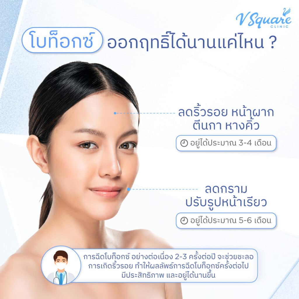 โบท็อกซ์ออกฤทธิ์ได้นานแค่ไหน