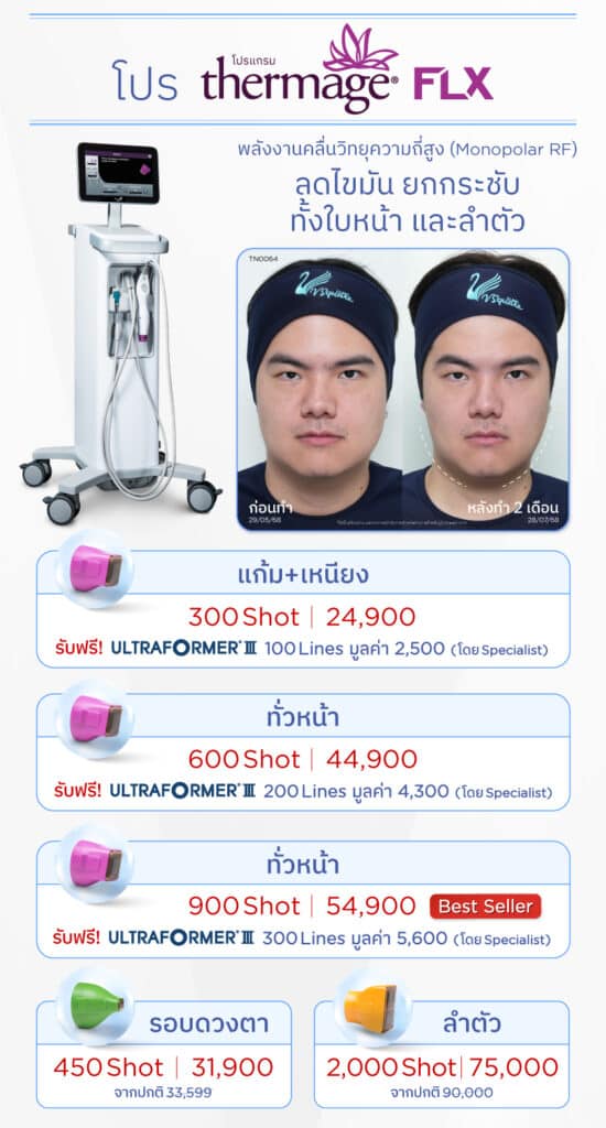 Thermage