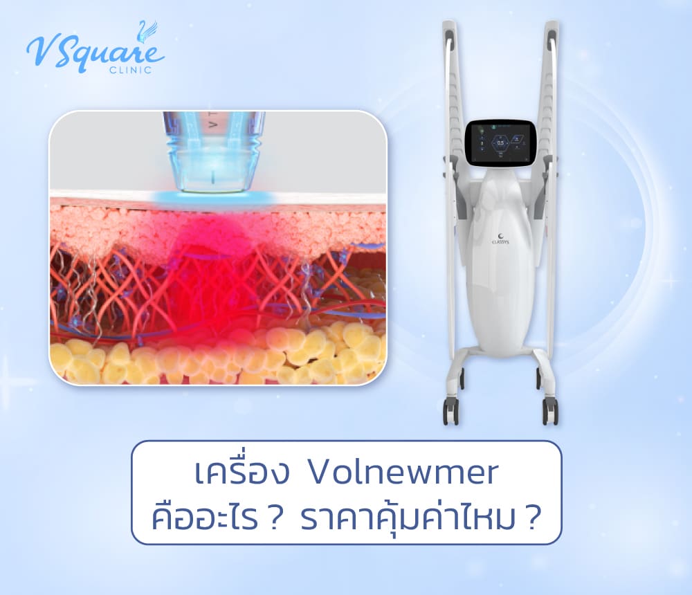 Volnewmer