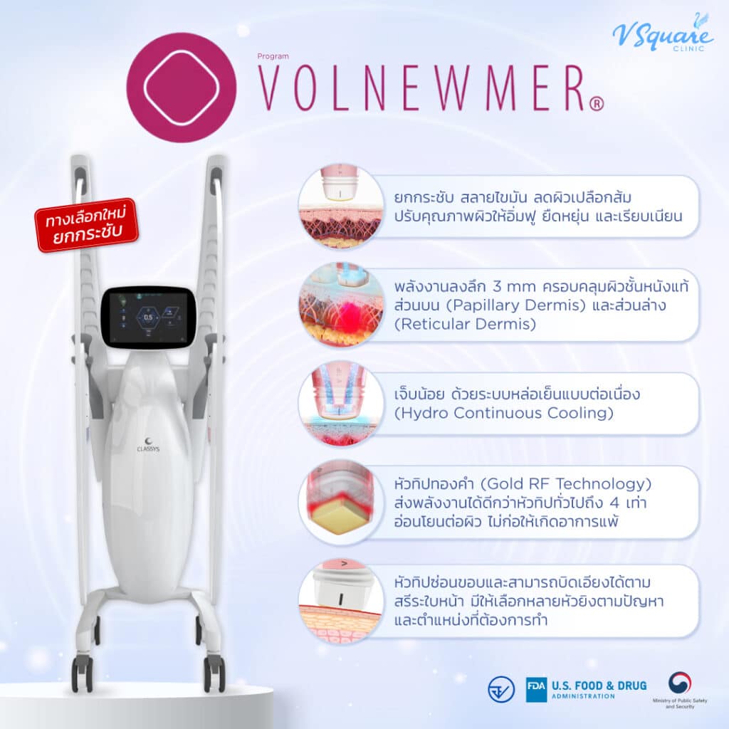 เครื่อง Volnewmer คืออะไร