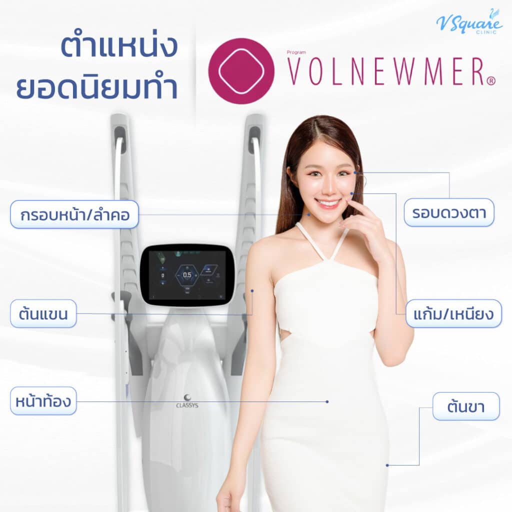 Volnewmer ทำตำแหน่งใดได้บ้าง