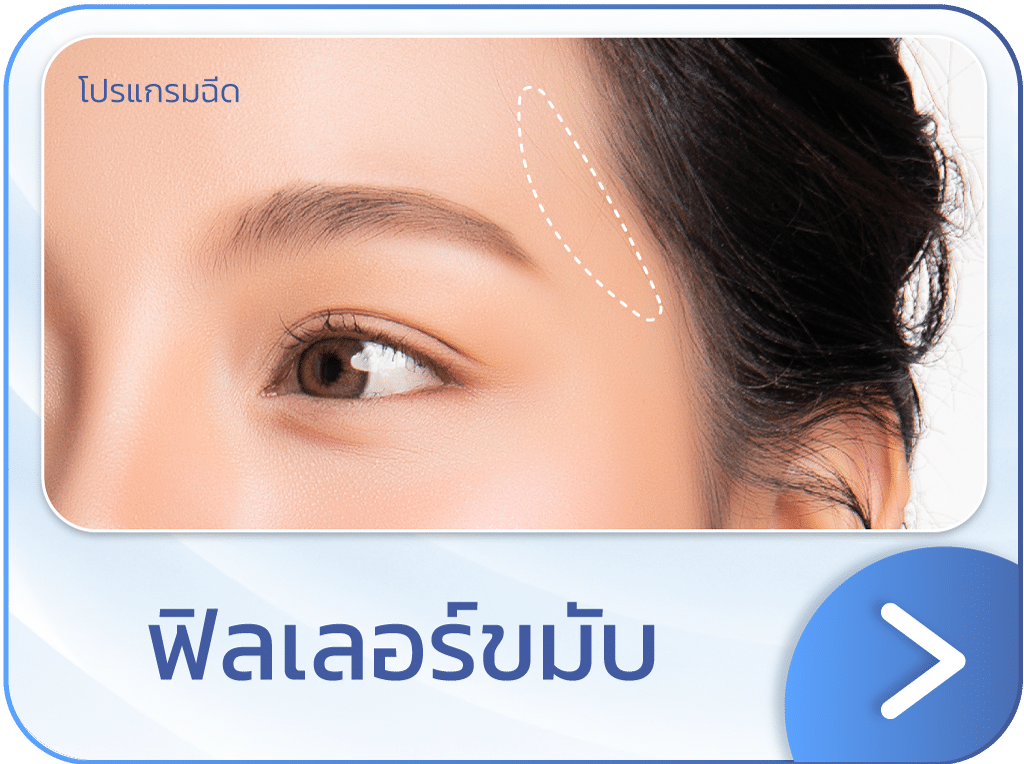 ฟิลเลอร์ขมับ