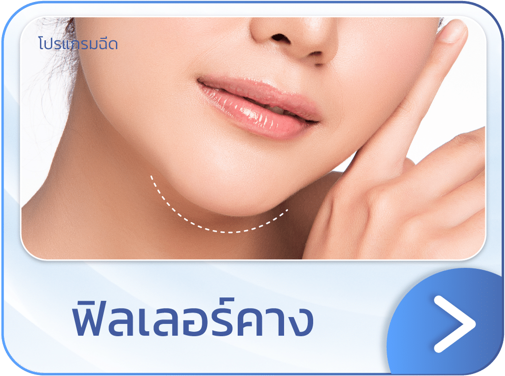 ฟิลเลอร์คาง