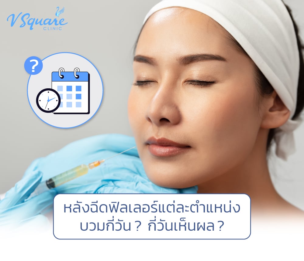 หลังฉีดฟิลเลอร์
