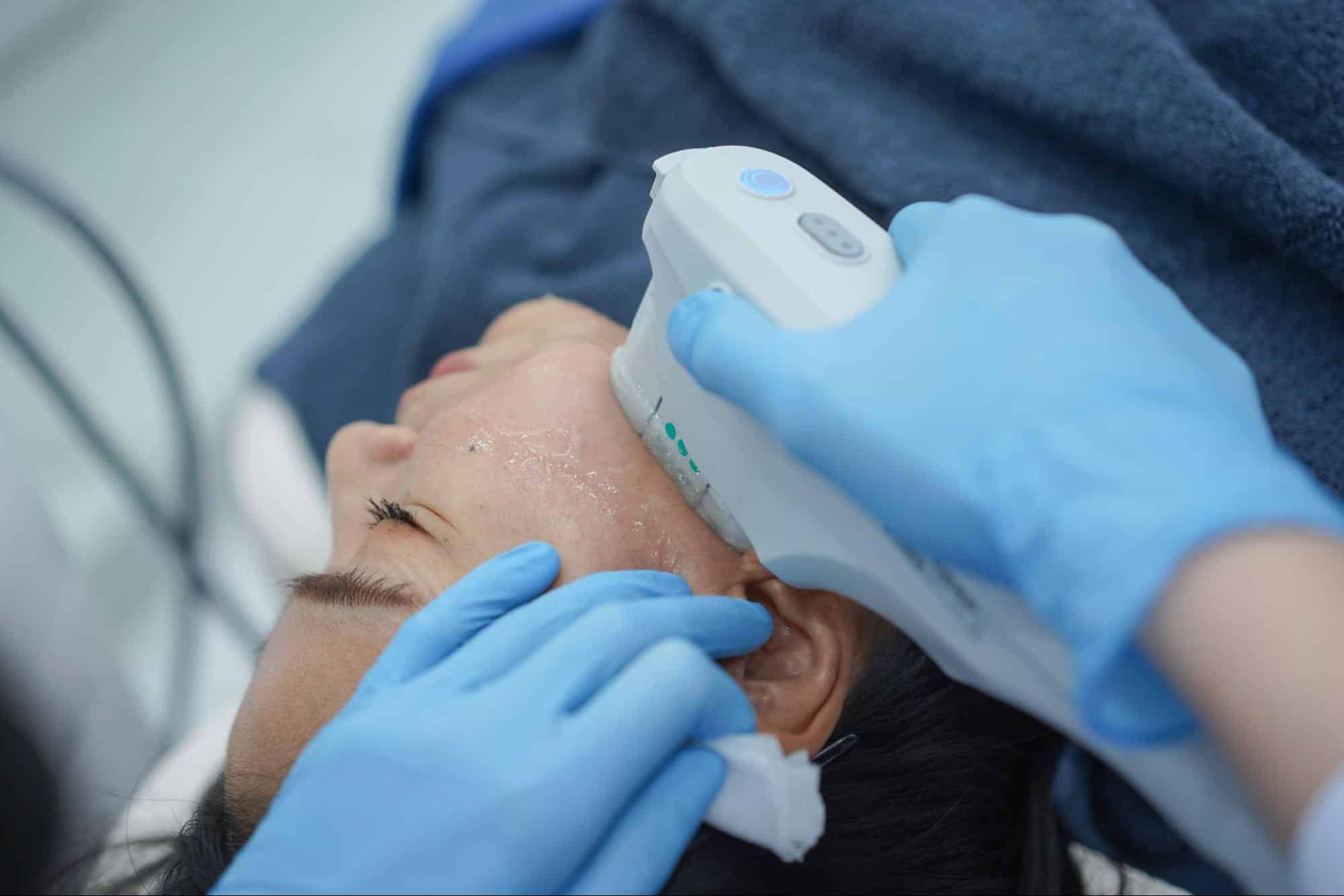 ทำ Ulthera ราคา ที่ V Square Clinic