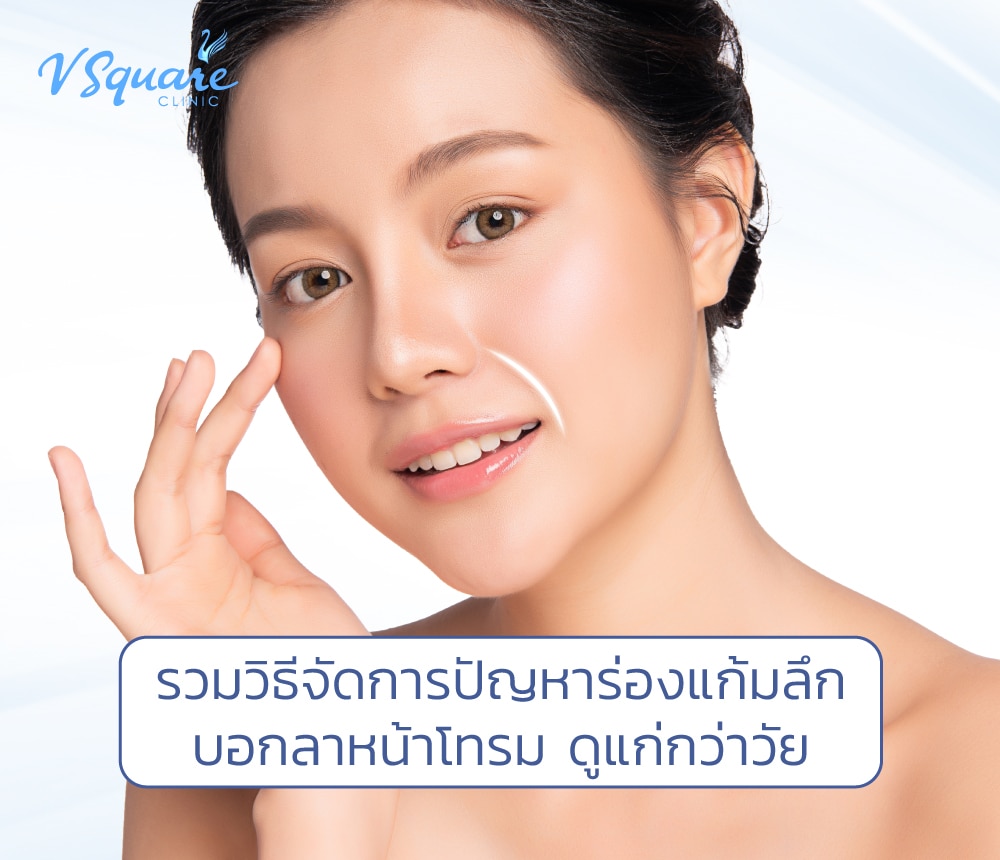 ร่องแก้มลึก