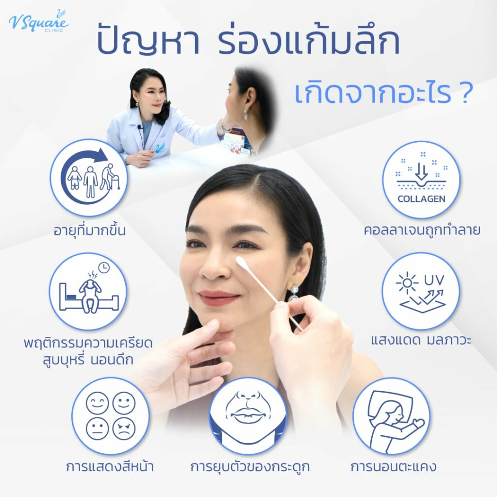 ร่องแก้มลึก เกิดจาก หมอเป้