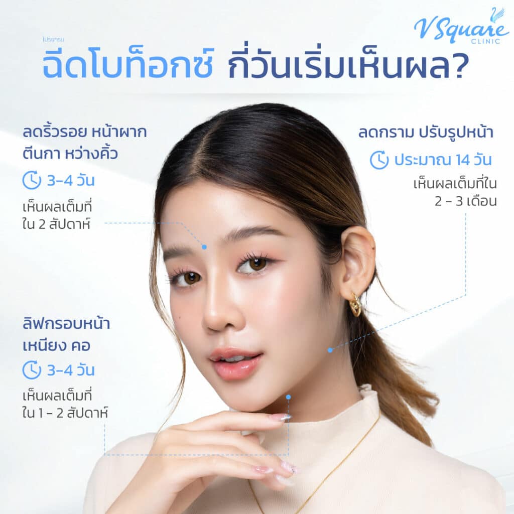 หลังฉีด Botox เกาหลี กี่วันเห็นผล