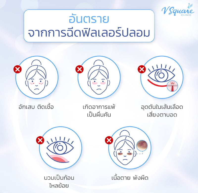 อันตรายจากฟิลเลอร์ปลอม