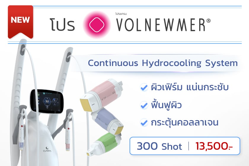 โปรโมชั่น Volnewmer