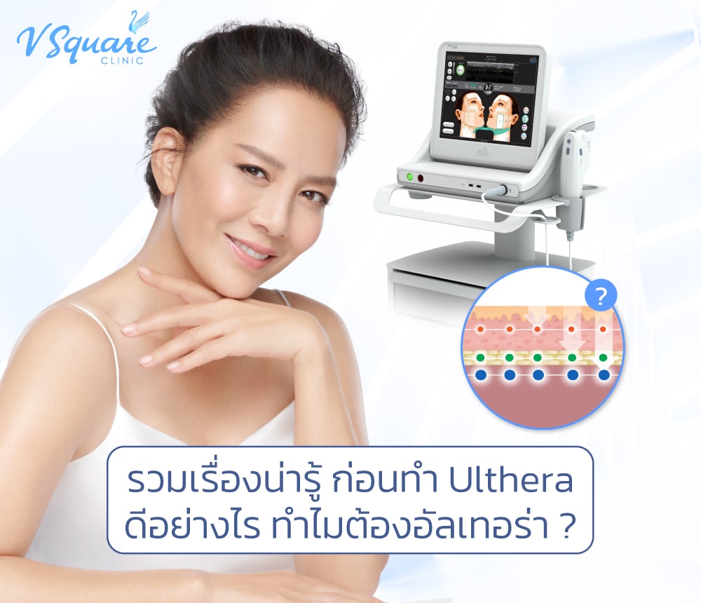 Ulthera