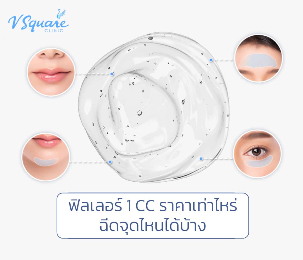 ฟิลเลอร์ 1 CC