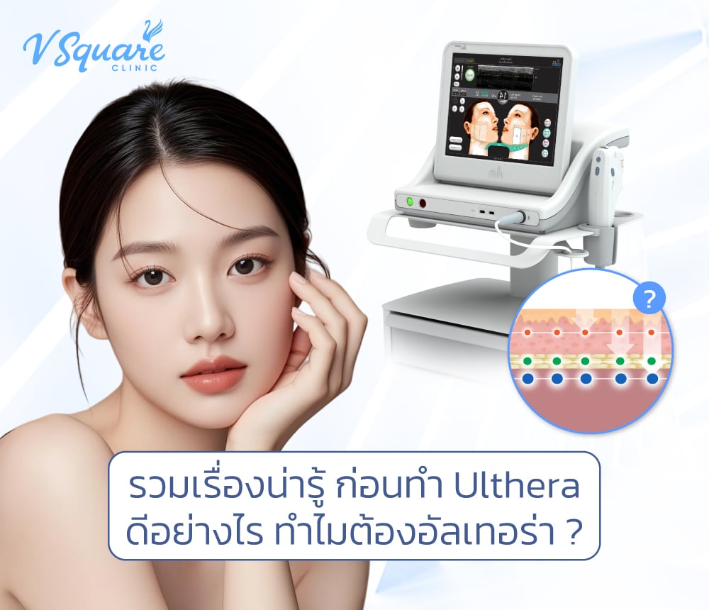 Ulthera