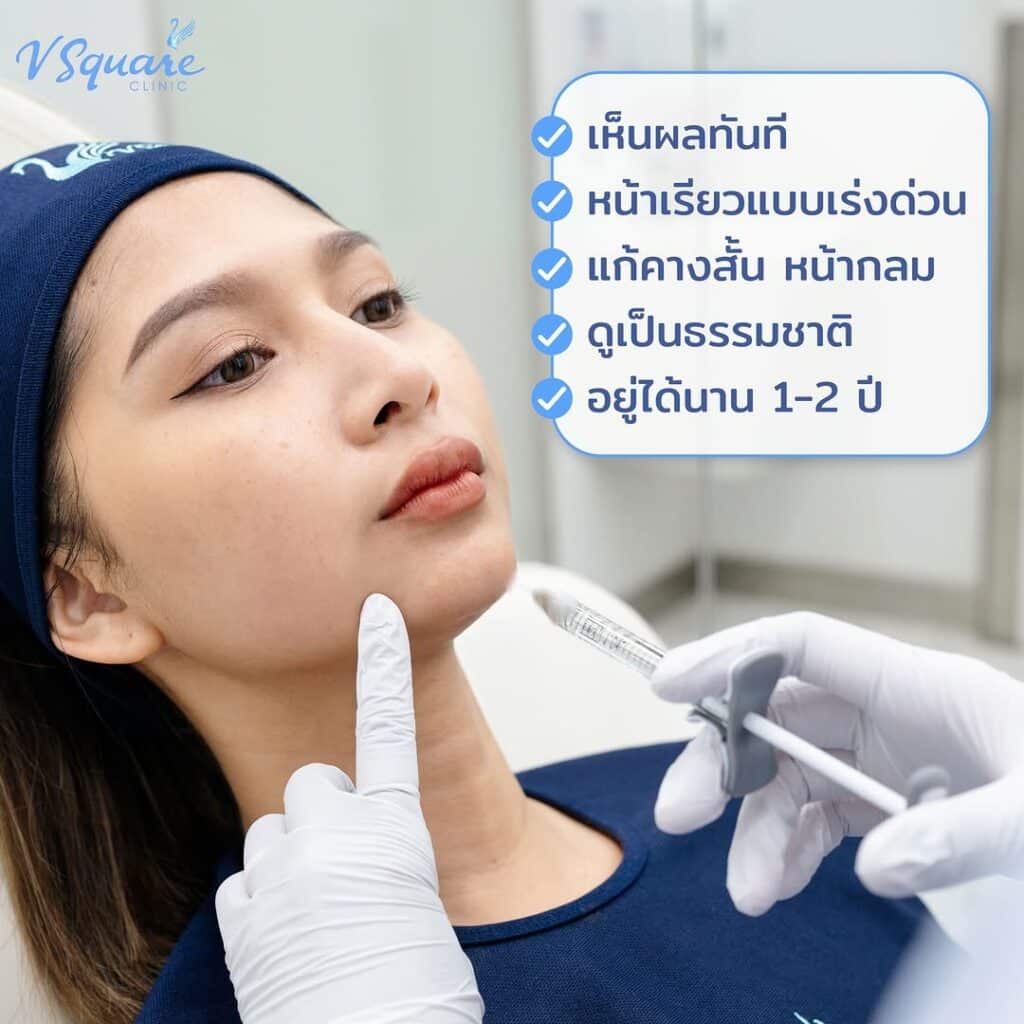 เติมฟิลเลอร์คาง