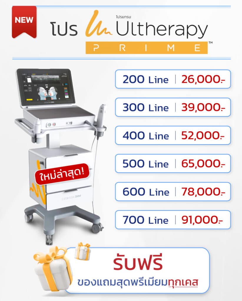 โปรโมชันอัลเทอร่าไพร์ม