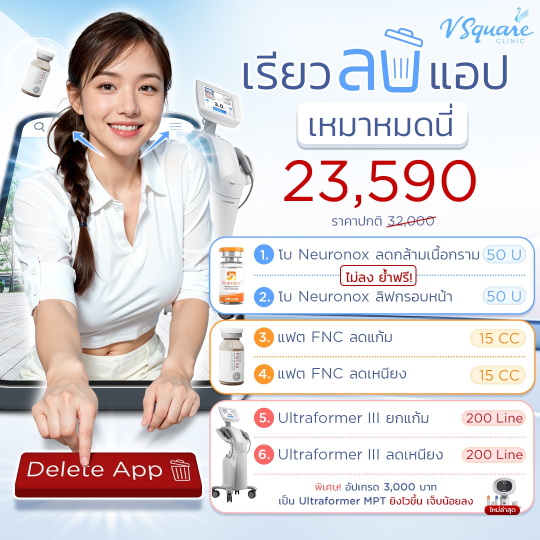 โปรเรียวลบแอป