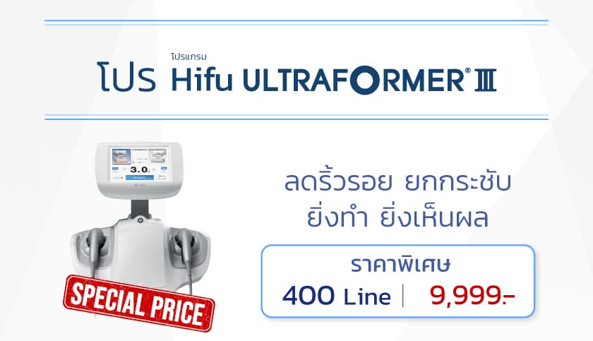 โปรโมชั่น Hifu