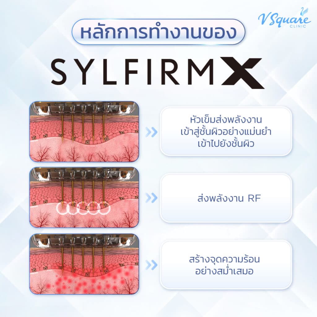 Mechanisms of Sylfirm X