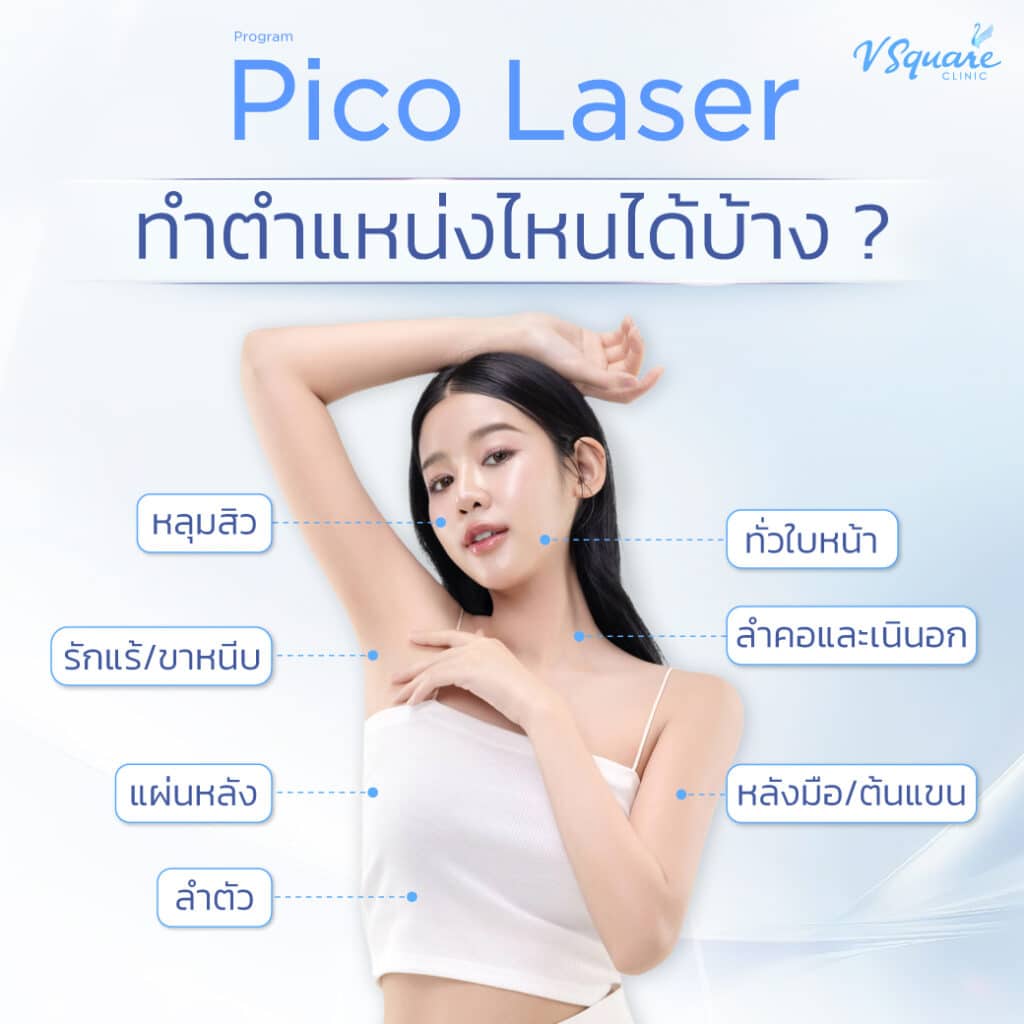 Pico Laser ทำตำแหน่งไหนได้บ้าง