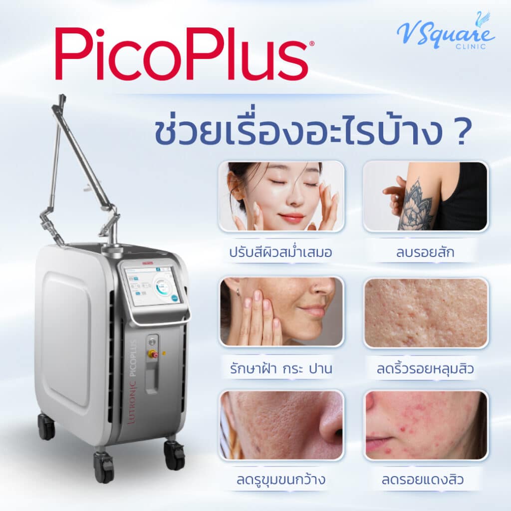 Pico Plus Laser คืออะไร ? ดีไหม ? ช่วยเรื่องอะไรบ้าง