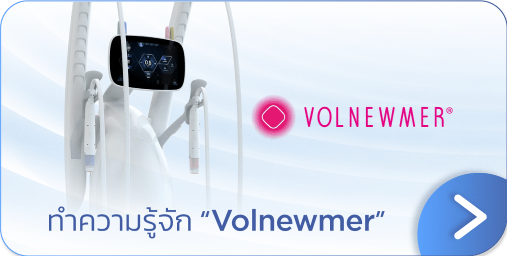 Volnewmer คืออะไร