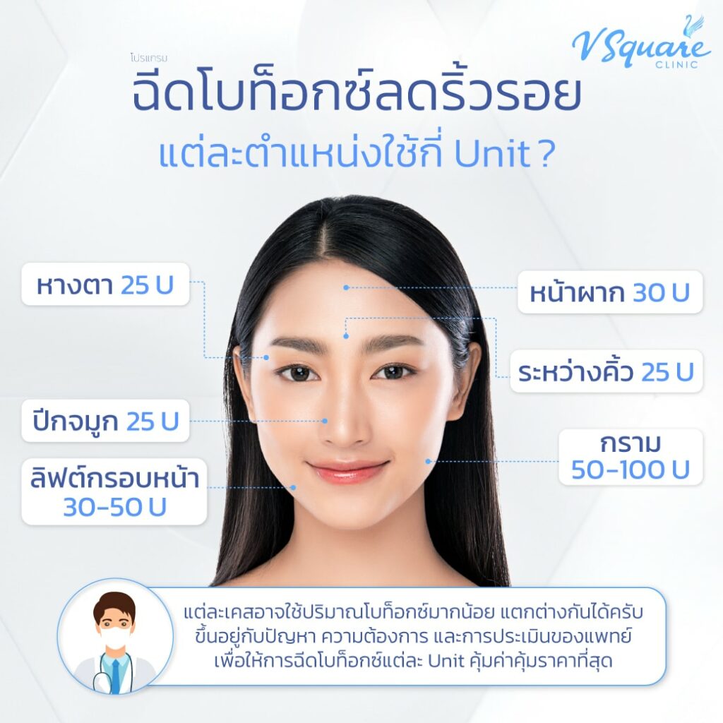ฉีดโบท็อกซ์ แต่ละตำแหน่งใช้กี่ Unit