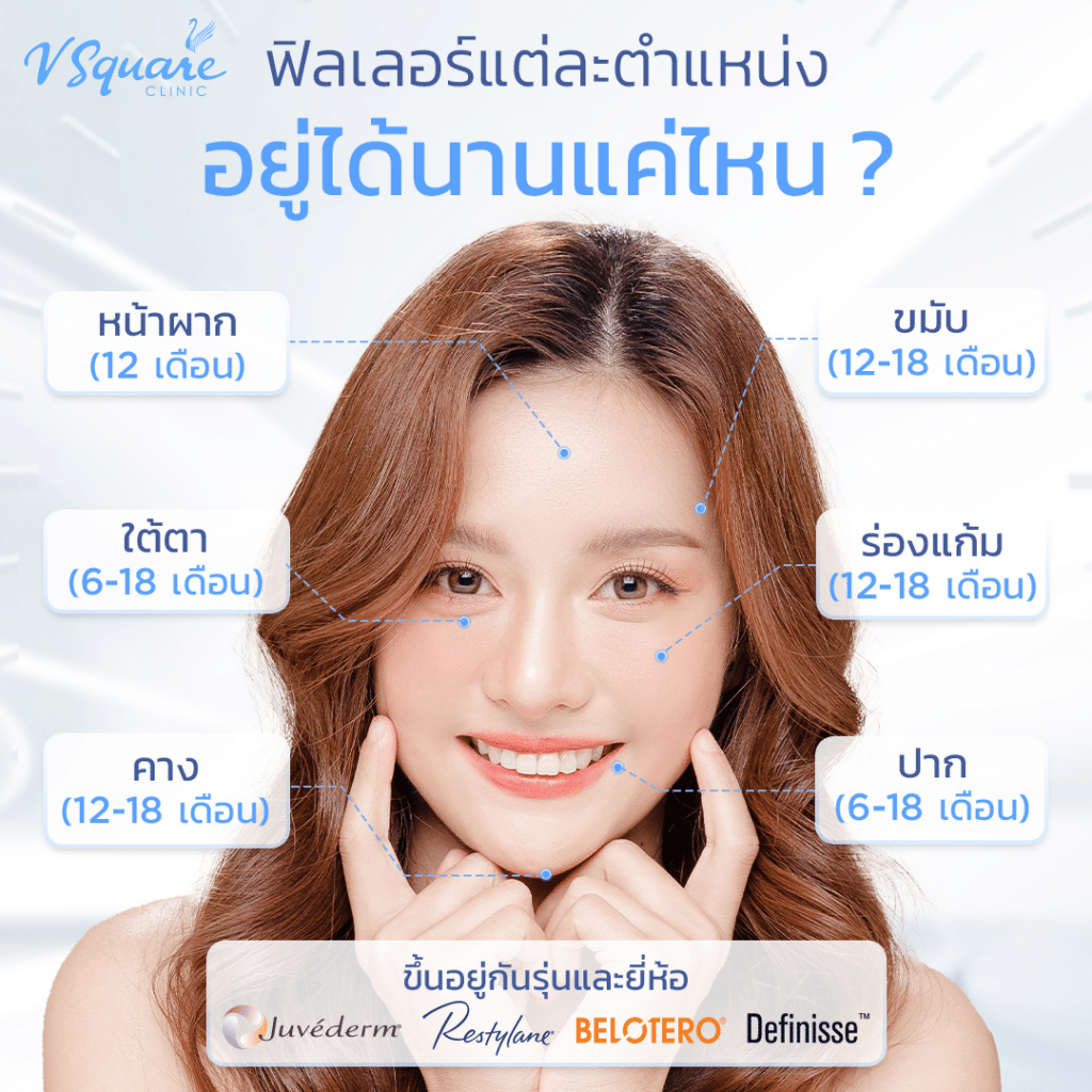 ฟิลเลอร์อยู่ได้นานไหม