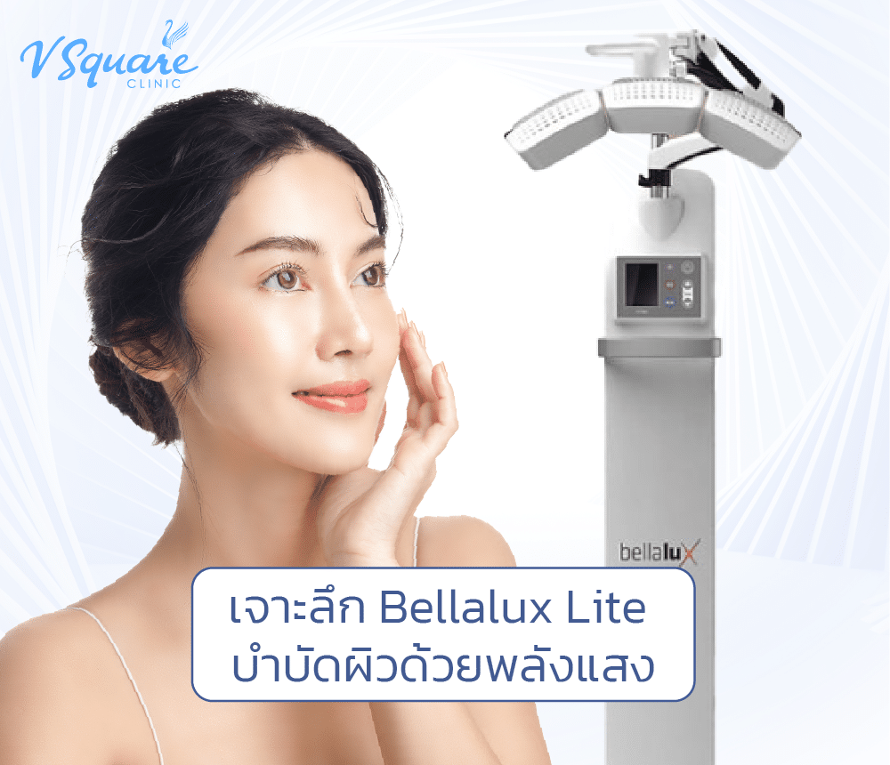 Bellalux Lite
