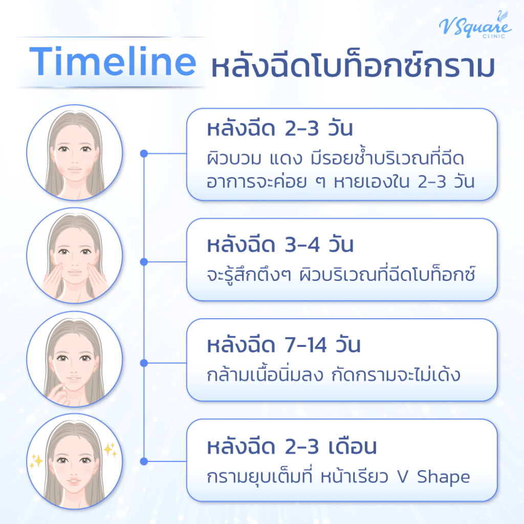 ฉีดโบลดกรามกี่วันเห็นผล