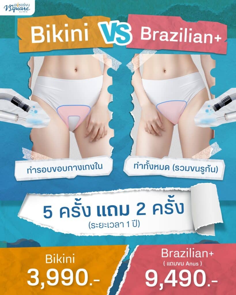 เลเซอร์ขนน้องสาวบุฟเฟ่ต์ ราคา