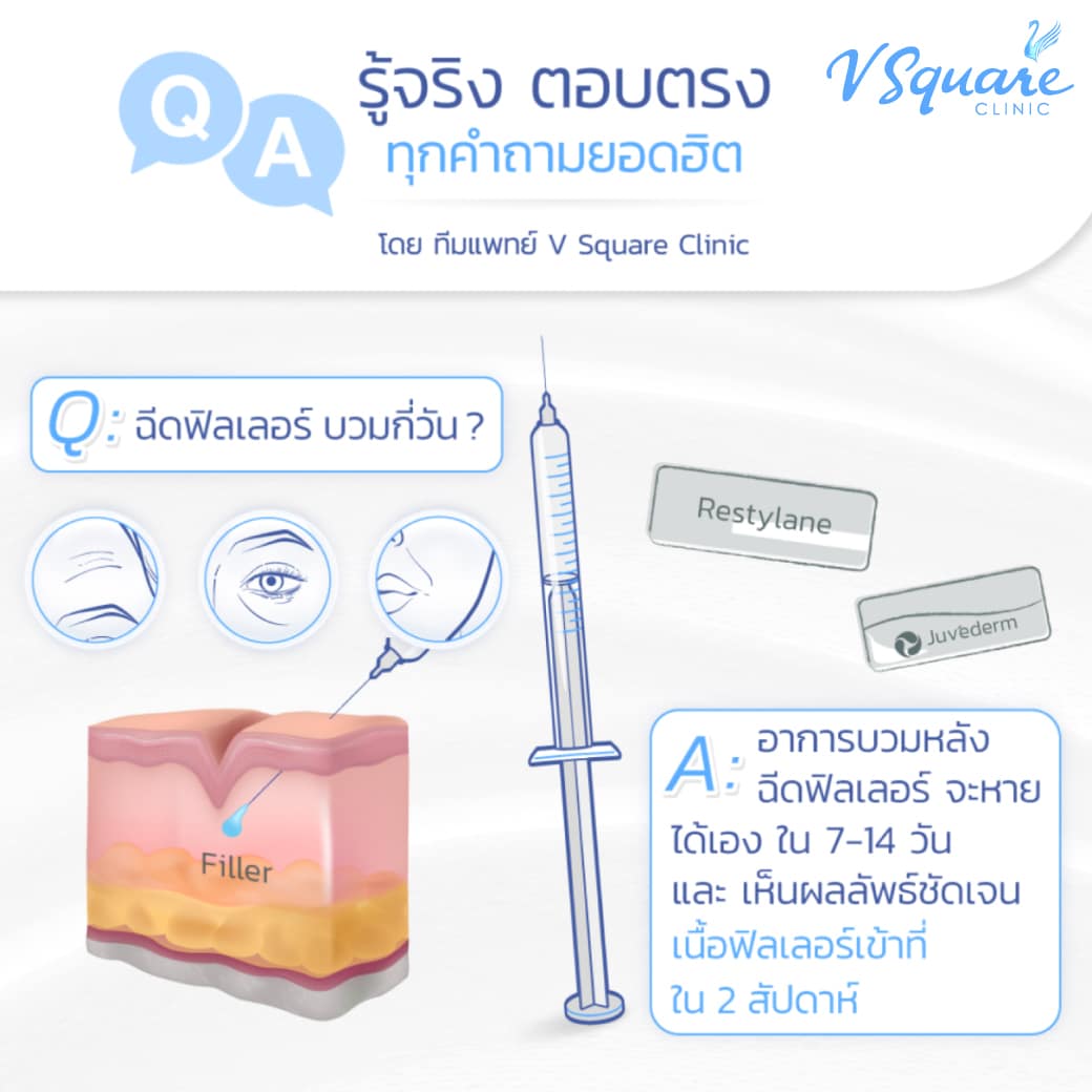 ฉีดฟิลเลอร์ e.p.t.q. บวมกี่วัน