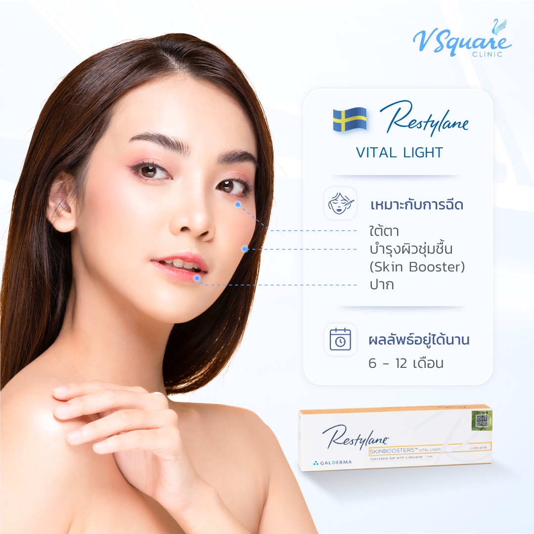 ตำแหน่งฉีด Restylane Vital Light