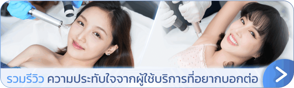 รีวิวเลเซอร์ขนที่ V Square Clinic