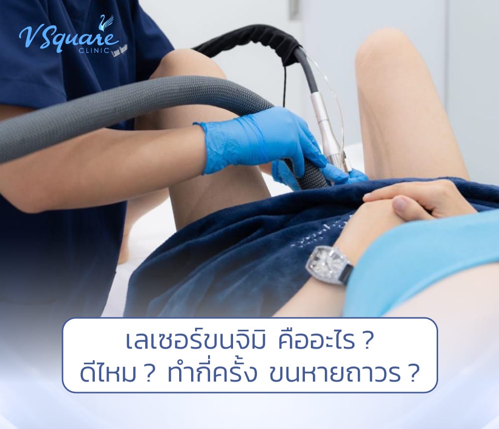 เลเซอร์ขนจิมิ
