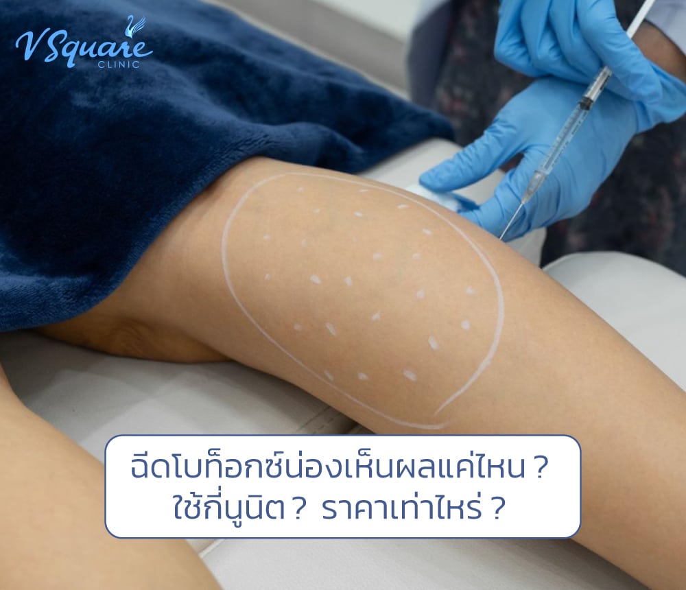 โบท็อกน่อง
