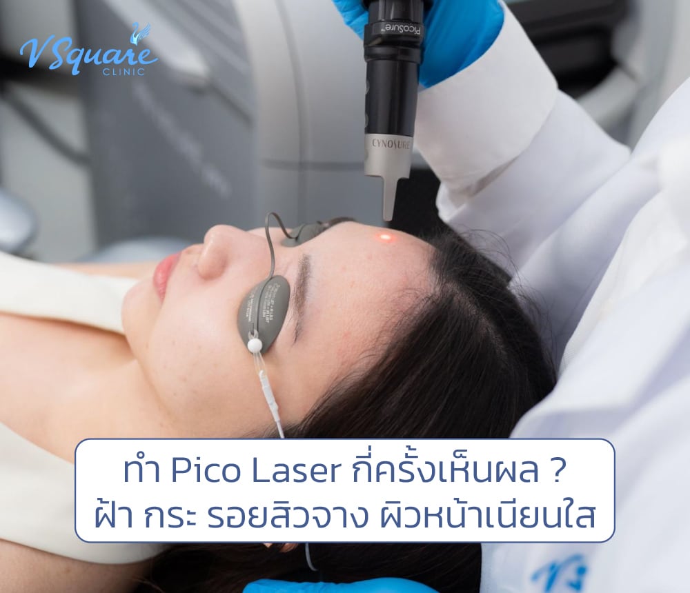 Pico Laser กี่ครั้งเห็นผล