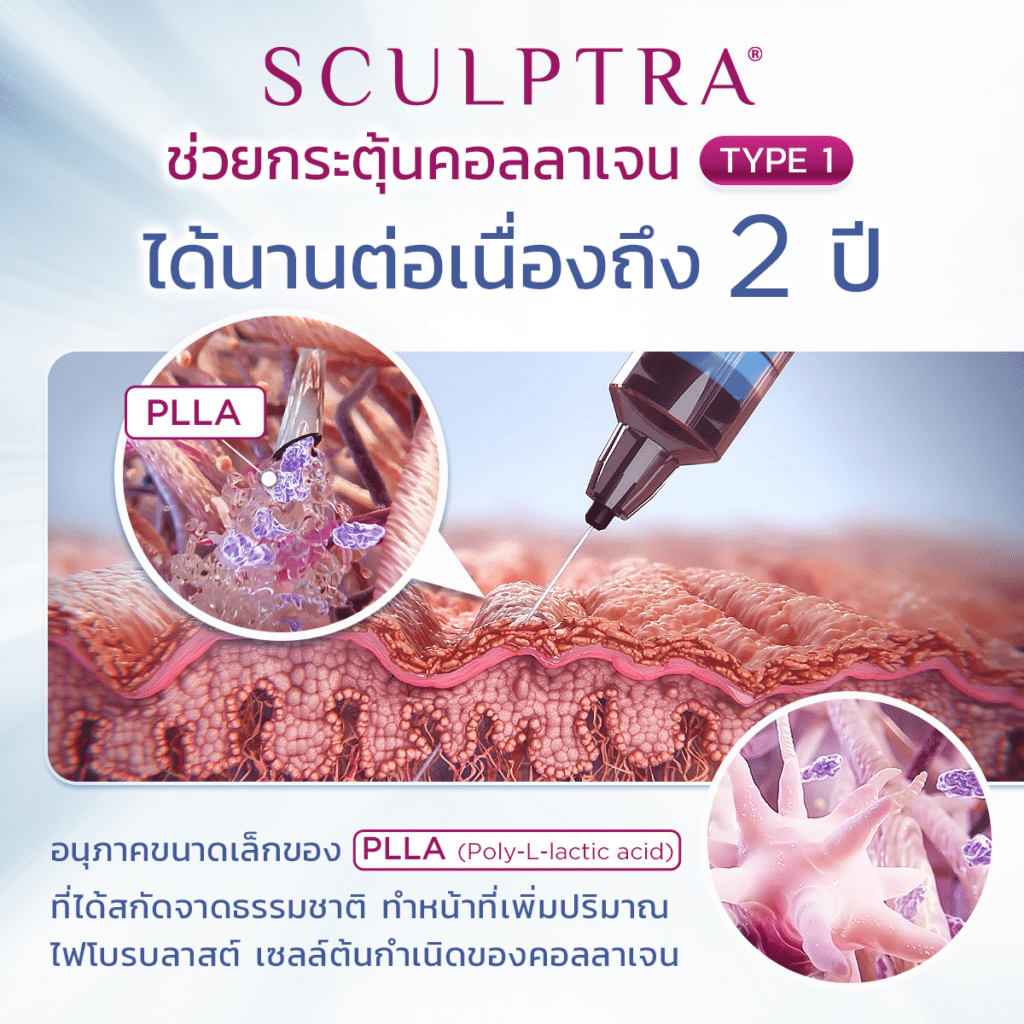 Sculptra กระตุ้นการคอลลาเจน