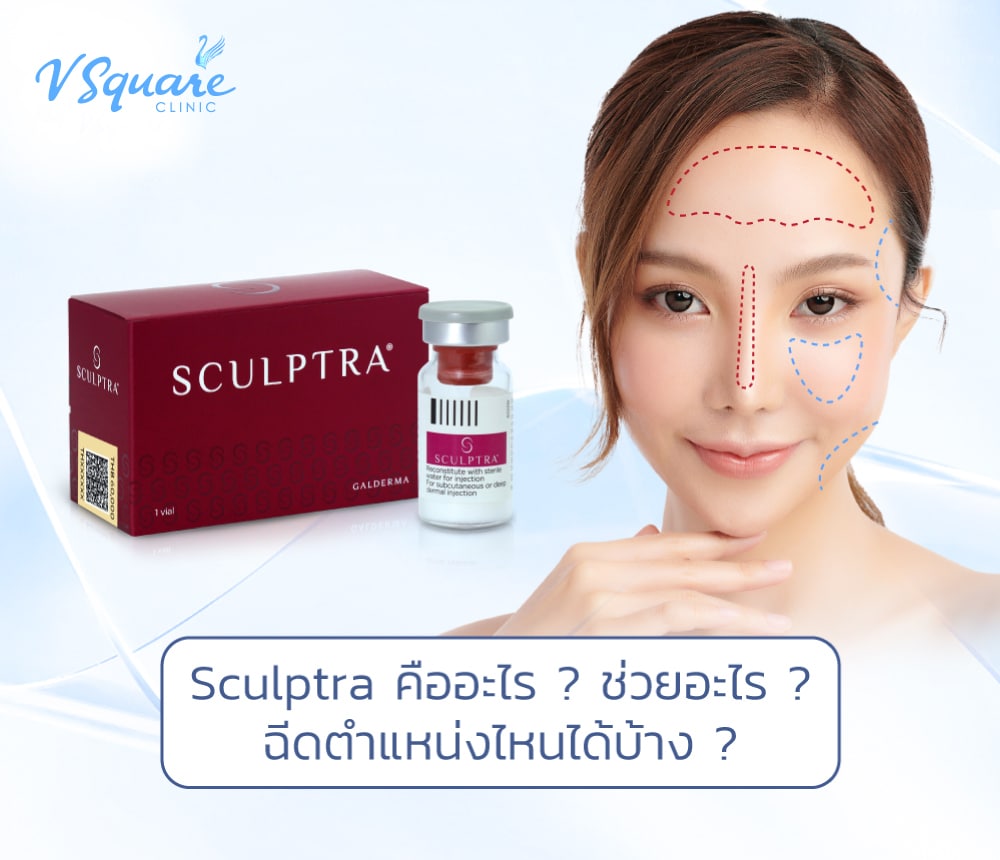 Sculptra