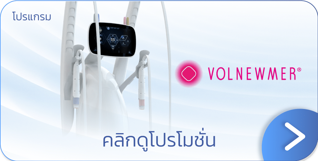 Volnewmer ราคา