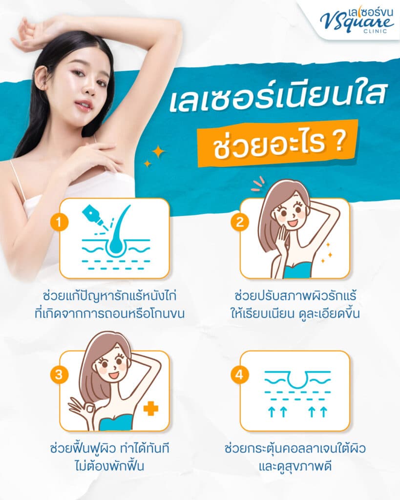 Yag Reju เลเซอร์เนียนใส ช่วยอะไร
