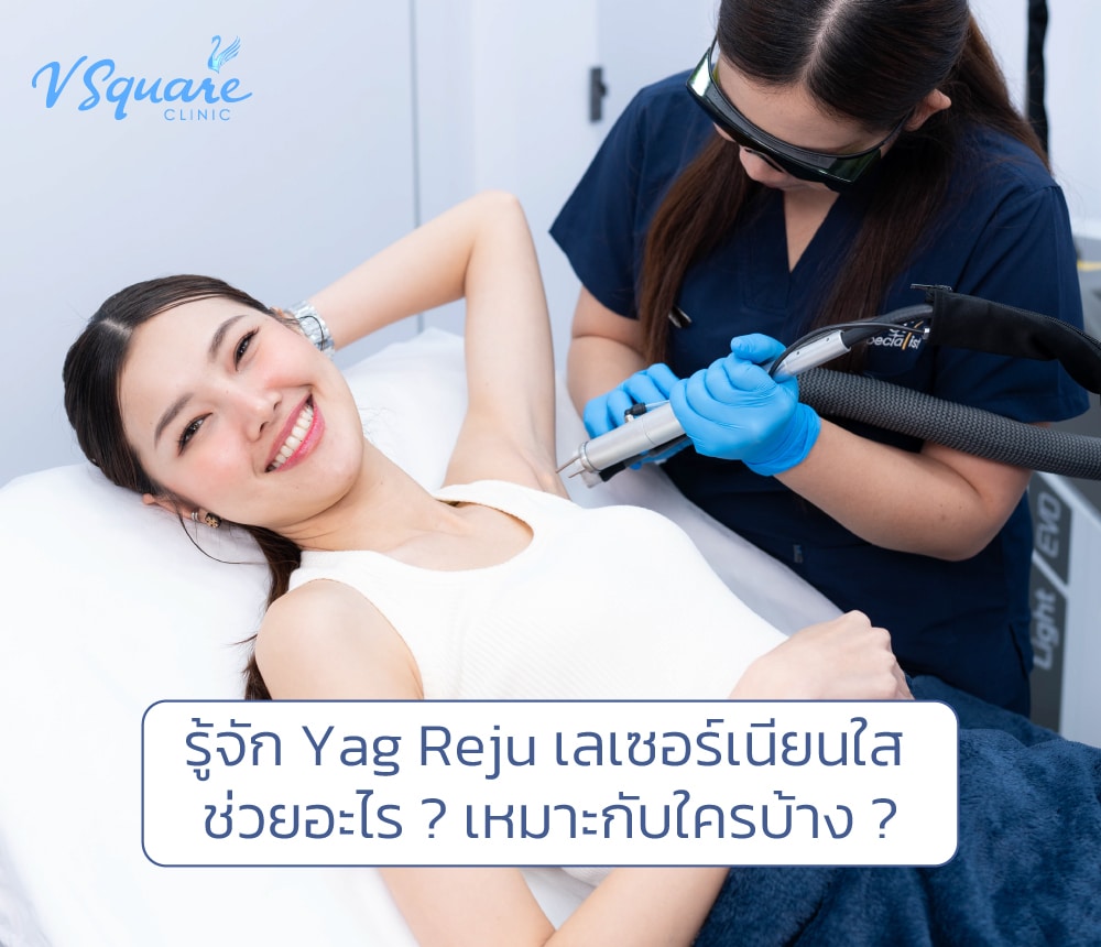 Yag Reju