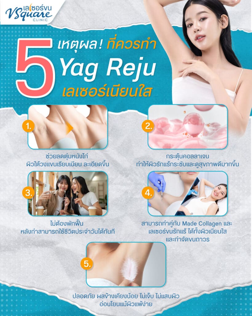 ข้อดีของ Yag Reju