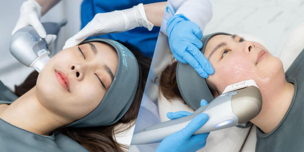 ทำ Hifu ที่ V Square Clinic
